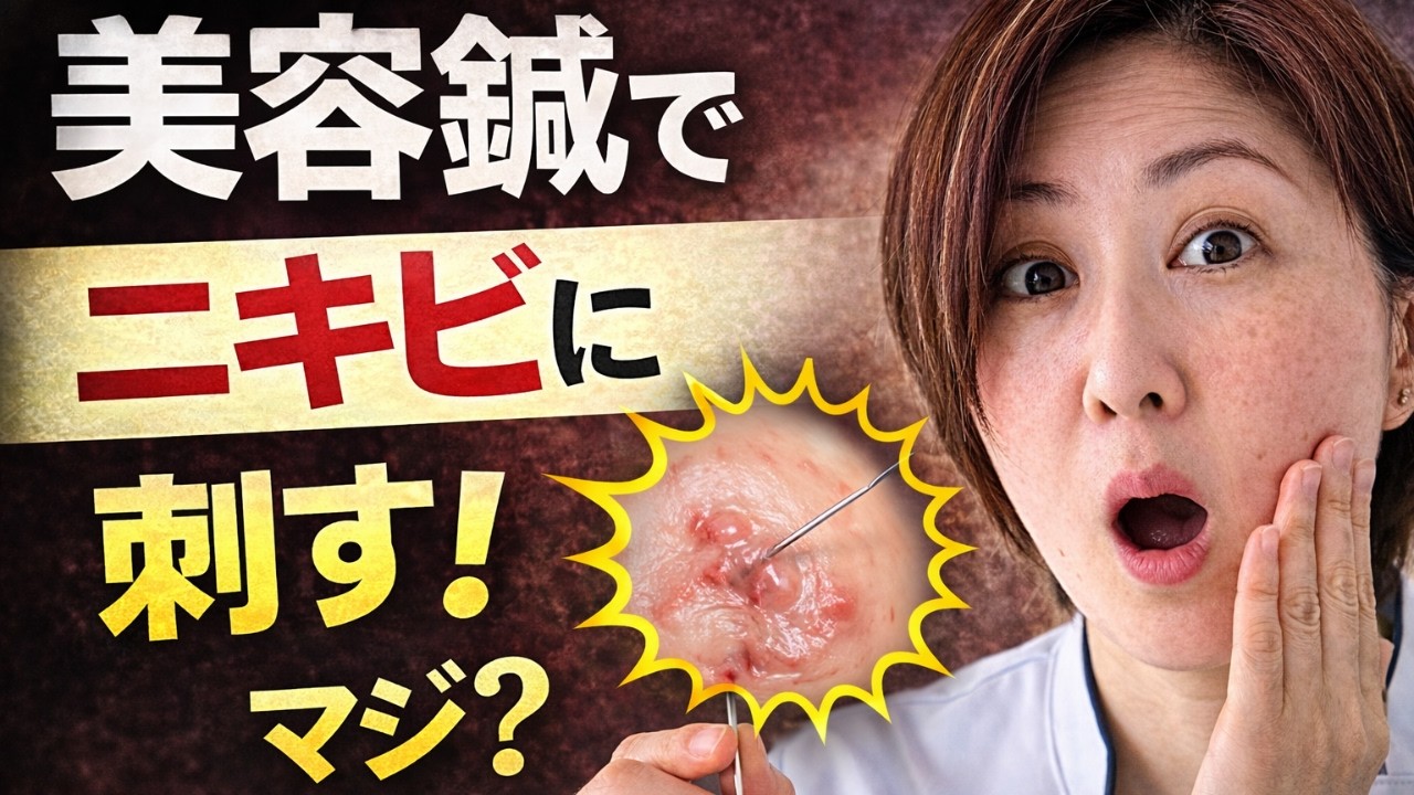 美容鍼をニキビに刺すと治る？それ、実は…