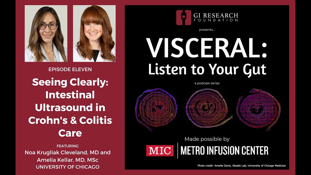 Visceral: Podcast Episode - Seeing Clearly: Intestinal Ultrasound in Crohn's & Colitis Care (ep 11)