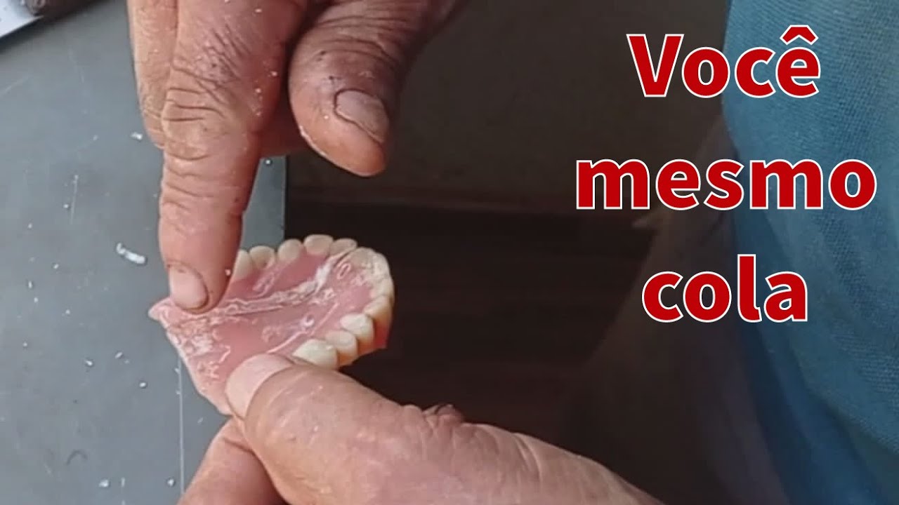 Como colar dentadura, partiu no meio