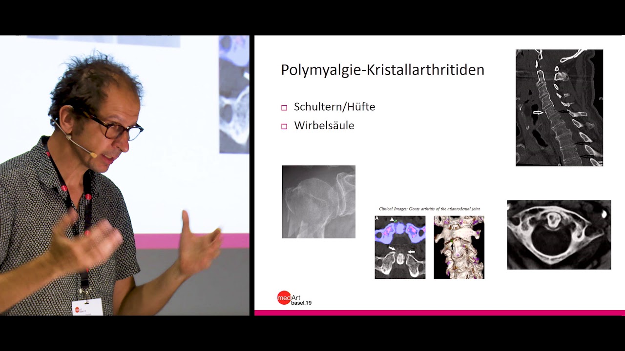 medArt2019: Donnerstag 03 T Daikeler Polymyalgie
