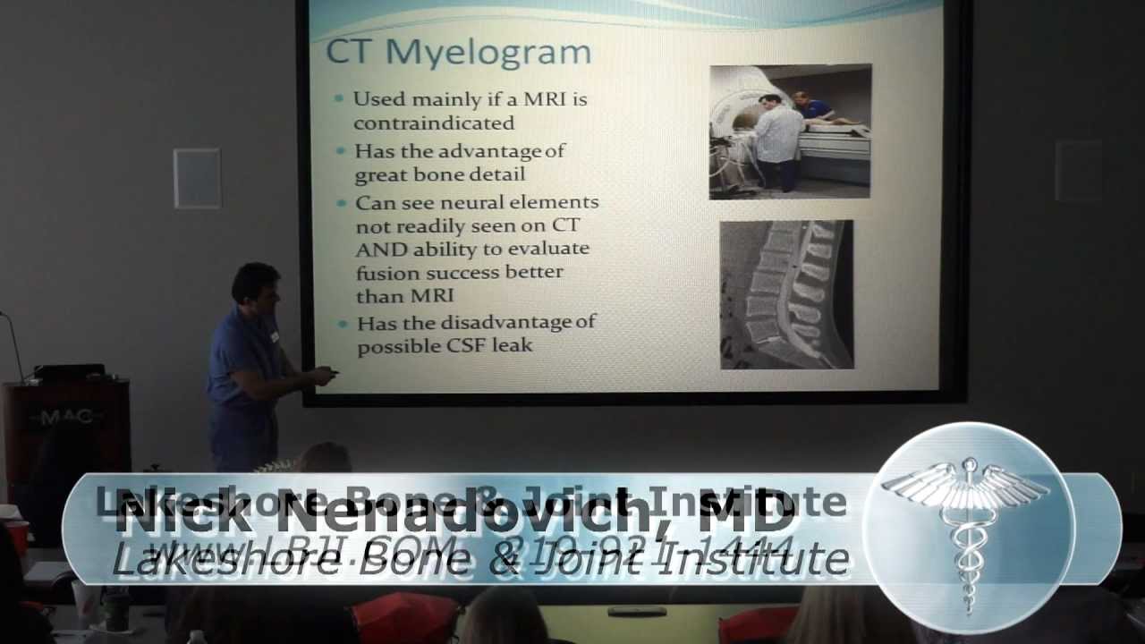 What is a CT Myelogram- NWI Spine Surgeon Dr Nenadovich explains the CT Myelogram LBJI 219-921-1444