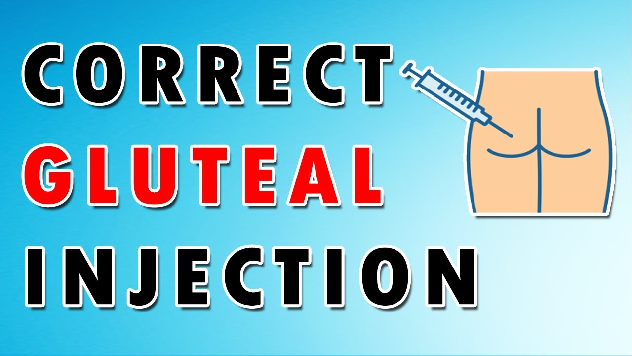 Proper Buttock (Glute) Injection - Location, Nerves, and Needles