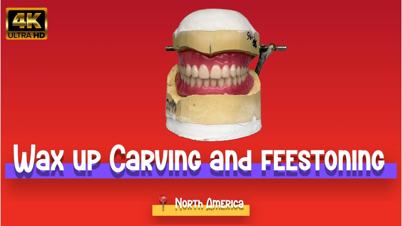 If You Love Dental Art… Don’t Miss This Wax-Up