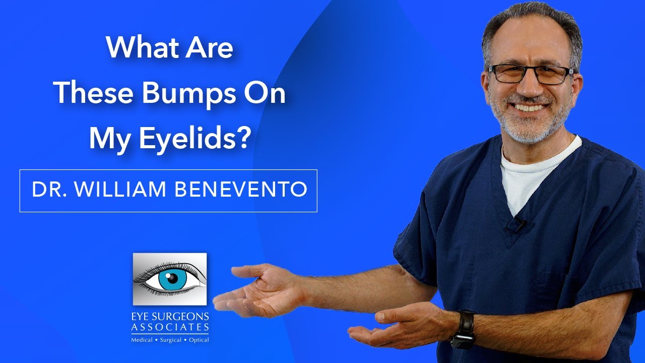 What Are These Bumps On My Eyelids? | Eye Surgeons Associates