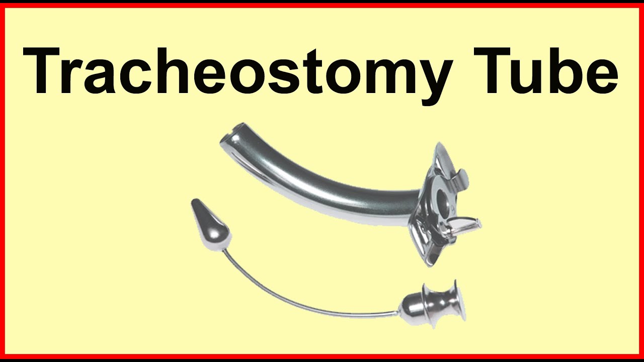 Tracheostomy tube | Trach cannula | Trach Care | Tube Metal tube de trach&eacute;otomie |
