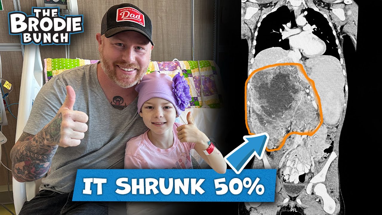 Ее опухоль уменьшилась на 50% + MIBG-сканирование нейробластомы.