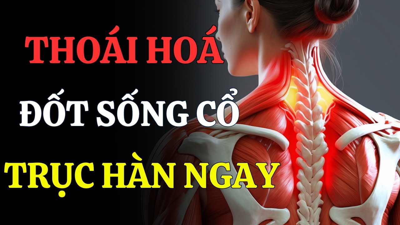 TRỤC KHÍ HÀN VÙNG CỔ GÁY – HÀN TẮC TÍCH LÂU LÀM CỔ THOÁI HÓA MÀ KHÔNG HAY