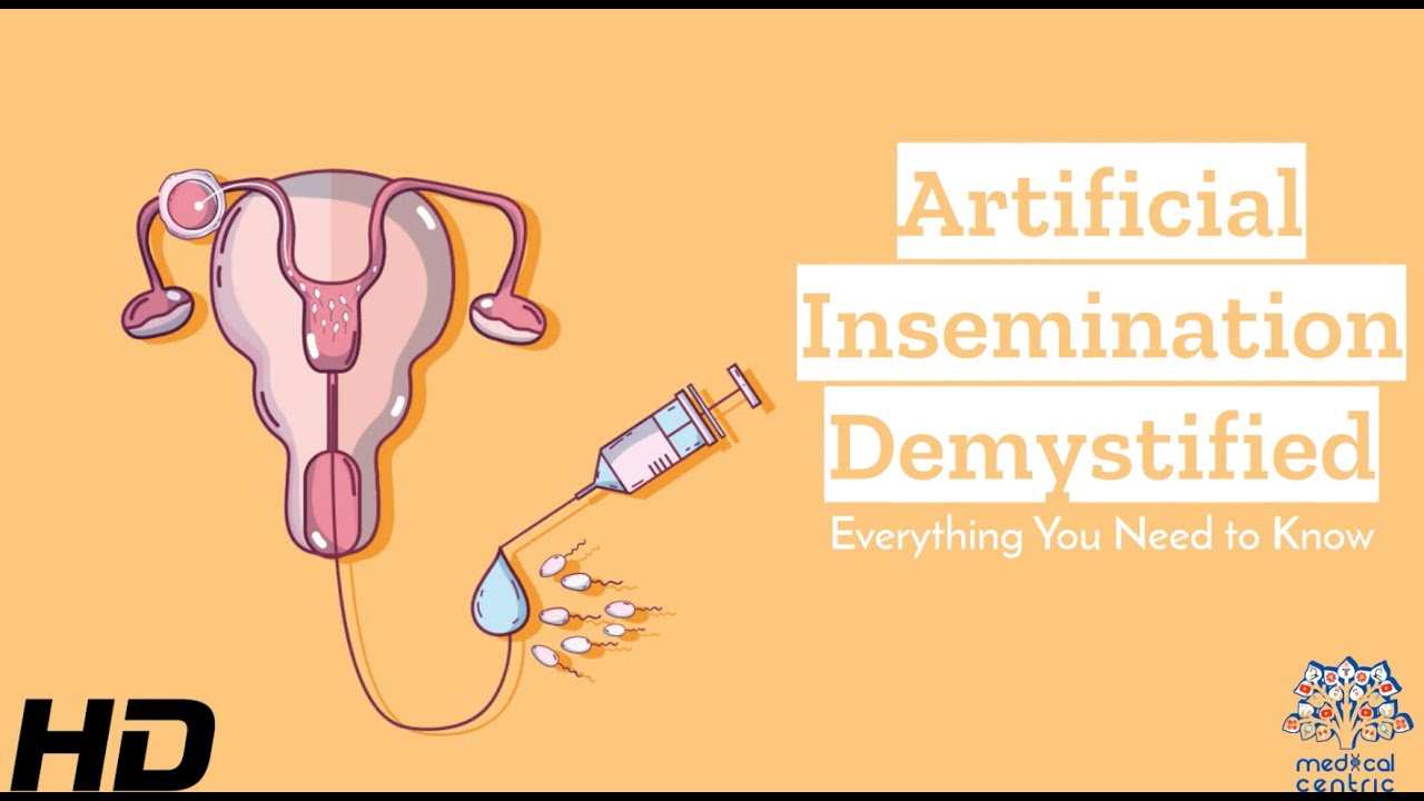 Artificial Insemination Explained: Making Informed Choices