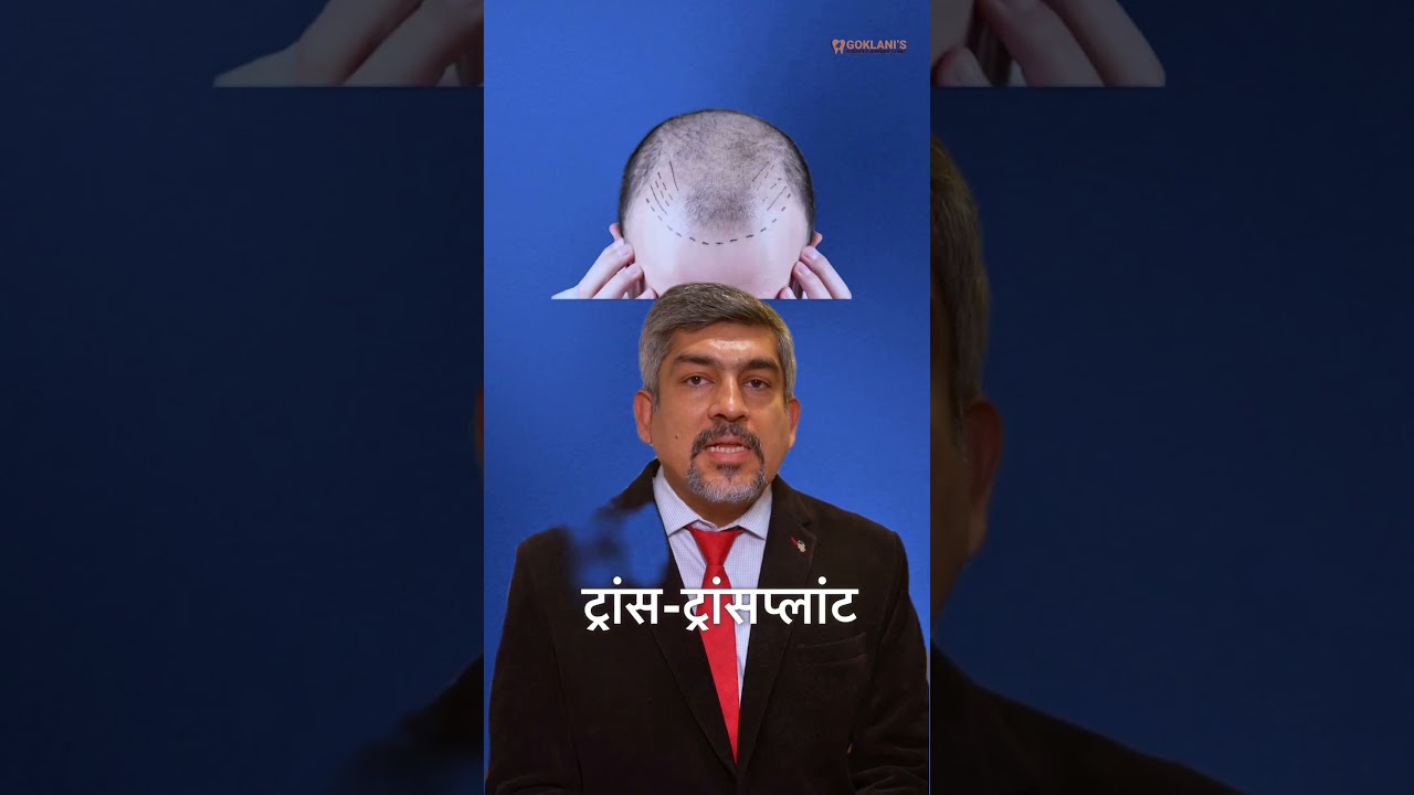 Hair Loss? Restore Your Hairline the Natural Way! | Dr. Mayur Goklani