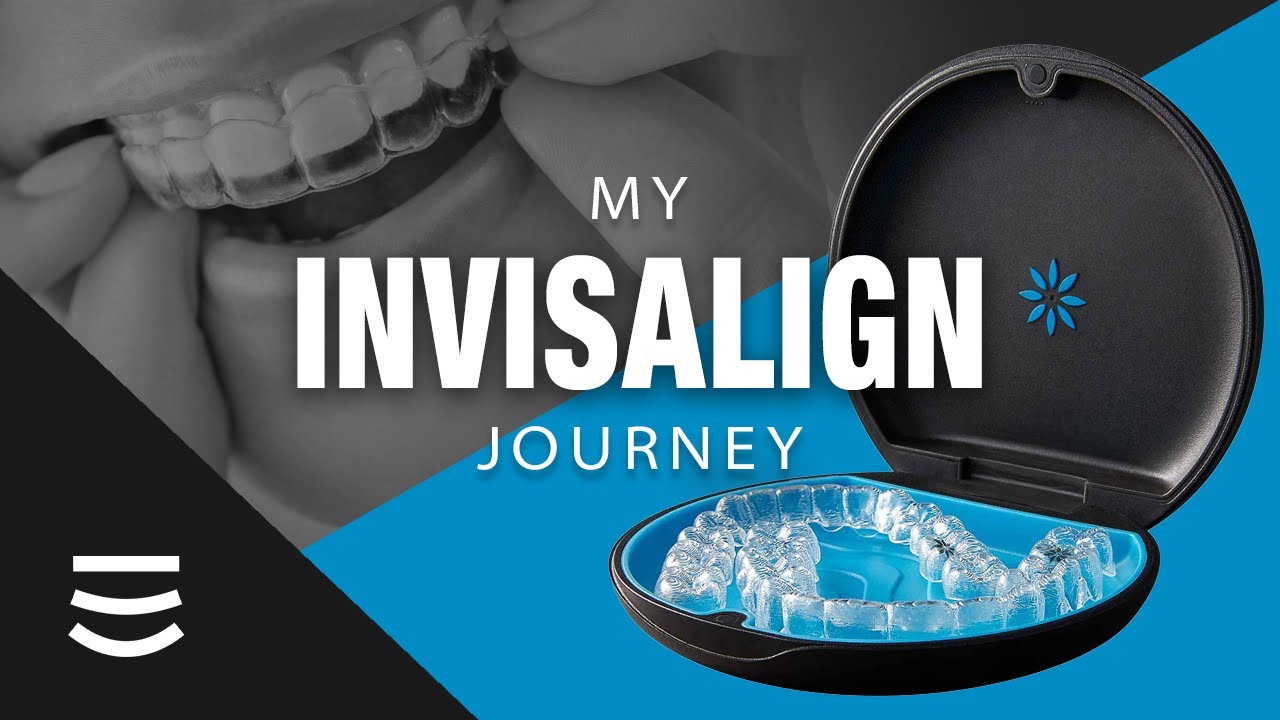 All About Invisalign | Stanley Dentistry