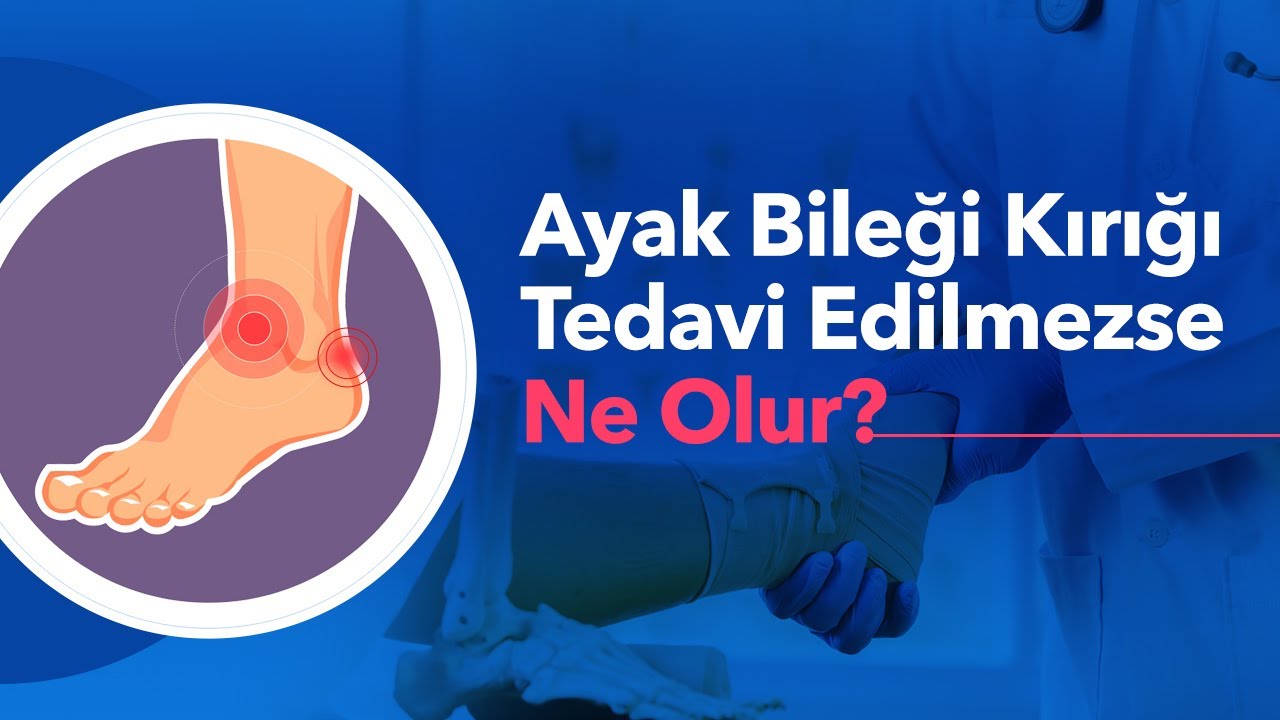 Ayak Bileği Kırığı Tedavi Edilmezse Ne Olur? Ayak Bileği Kırıkları Nasıl Olur? Prof. Dr. Hakan Özsoy