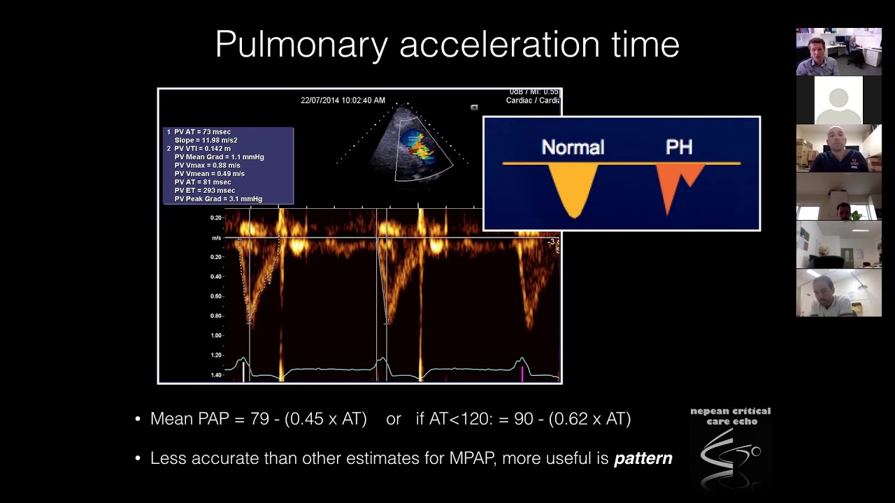 Pulmonary Haemodynamics