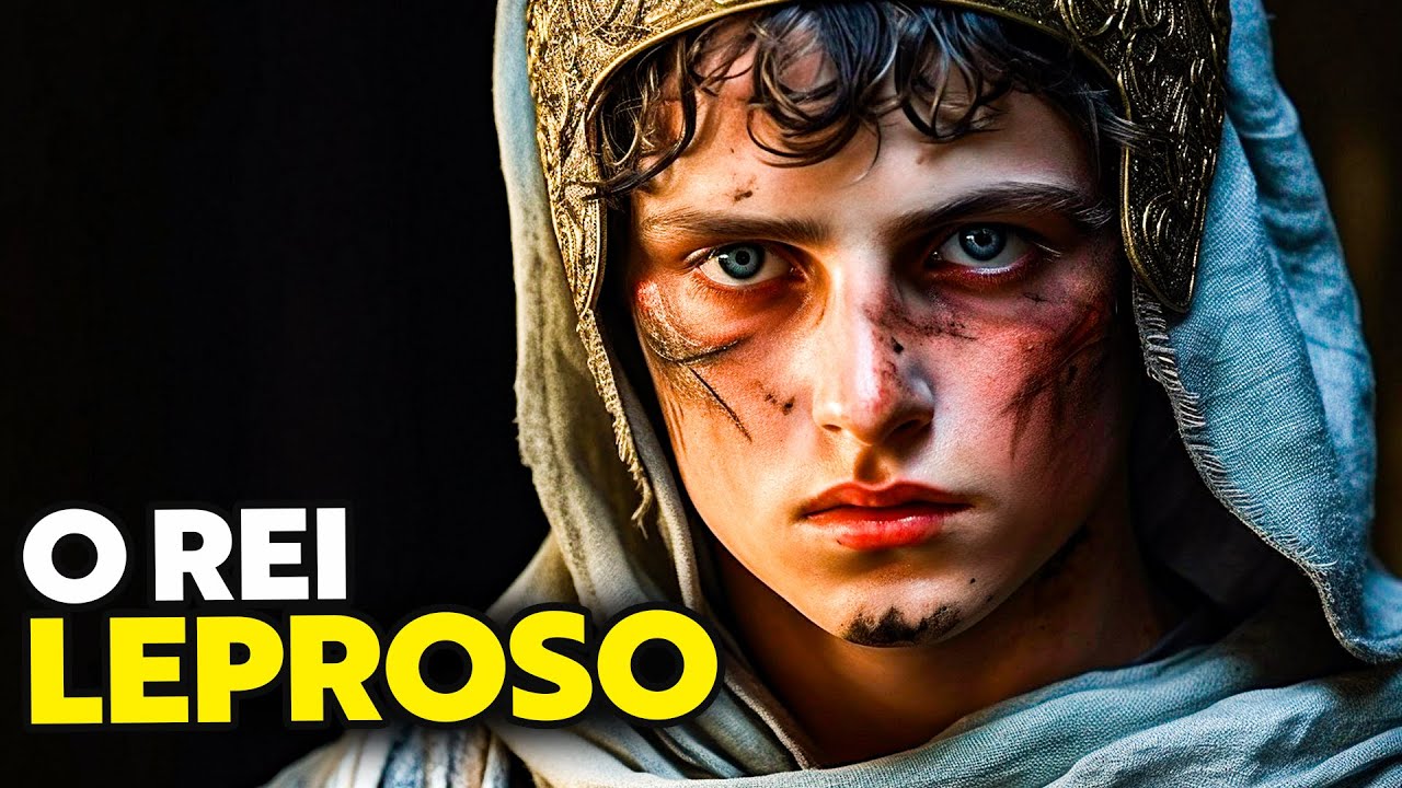 7 CURIOSIDADES SOBRE BALDU&Iacute;NO IV DE JERUSAL&Eacute;M - O REI LEPROSO