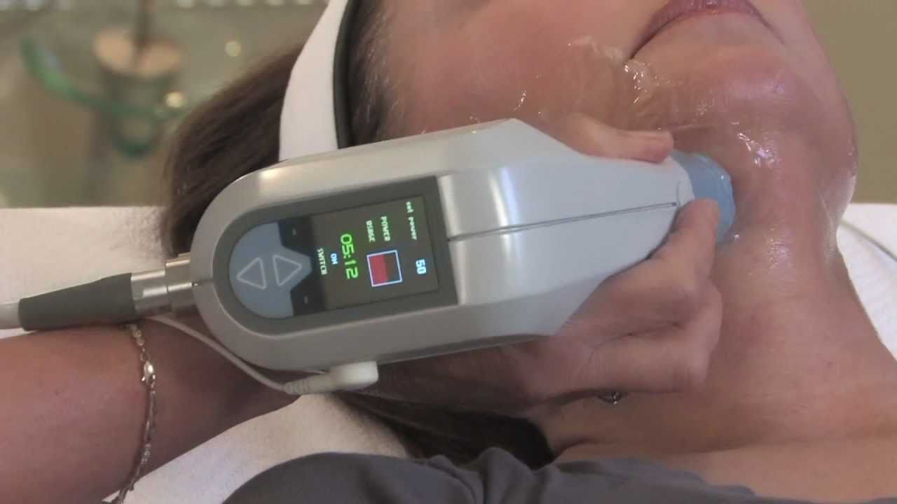Reduce wrinkles, tighten skin, improve collagen growth, lose inches with Exilis