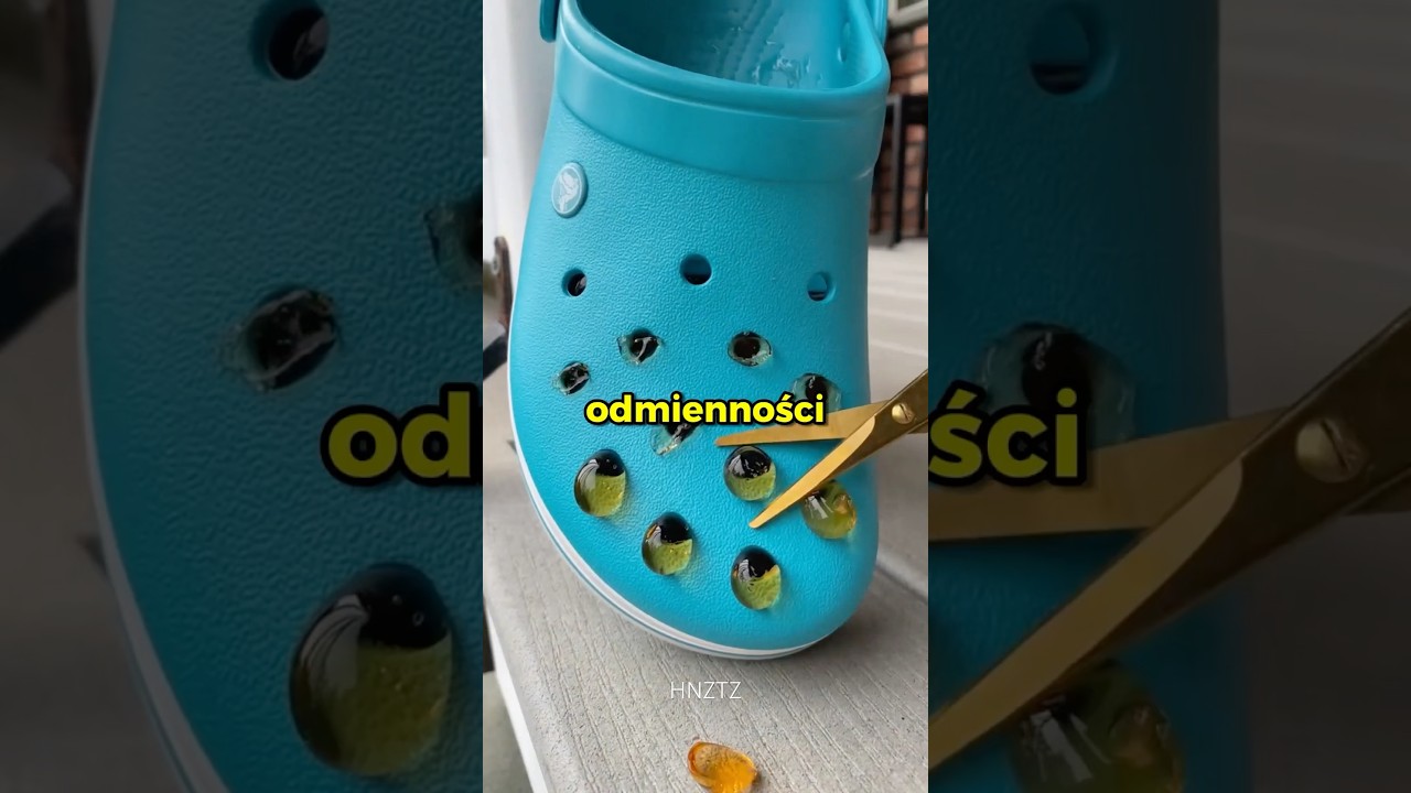 Zmusili Mnie Do Schudnięcia😰