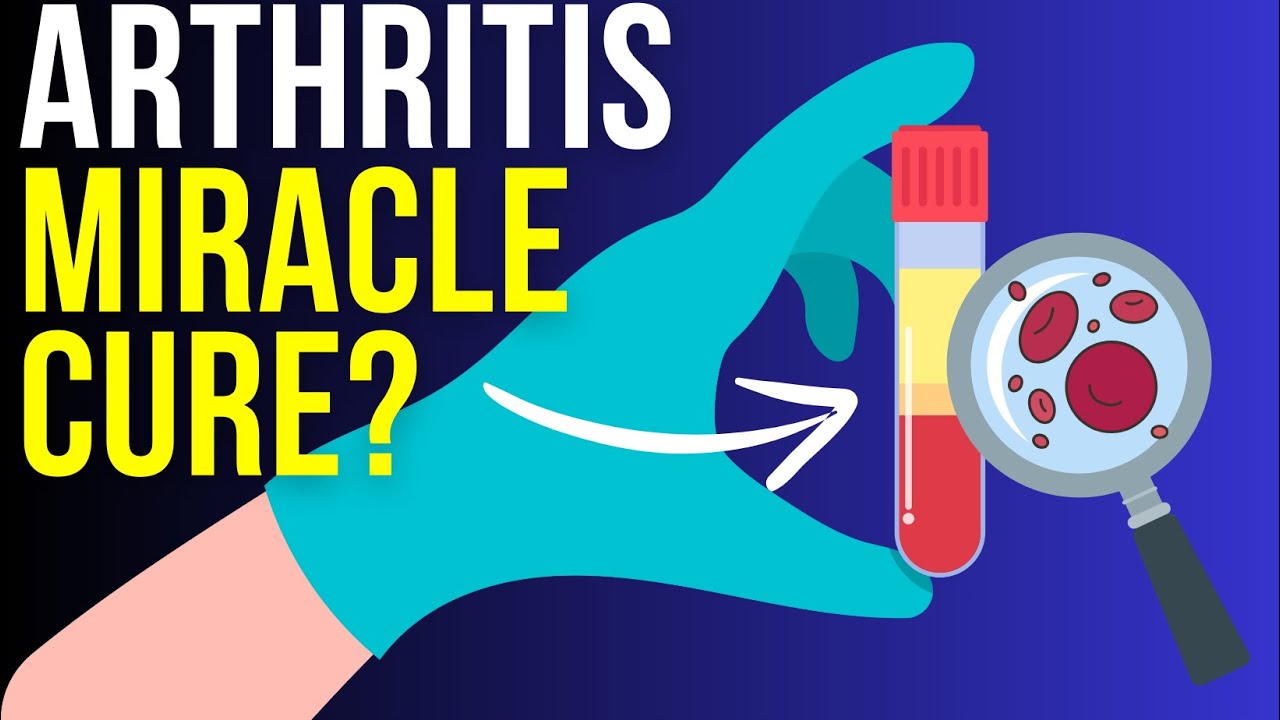 PRP (Platelet Rich Plasma) Injections: Do They Really Work?