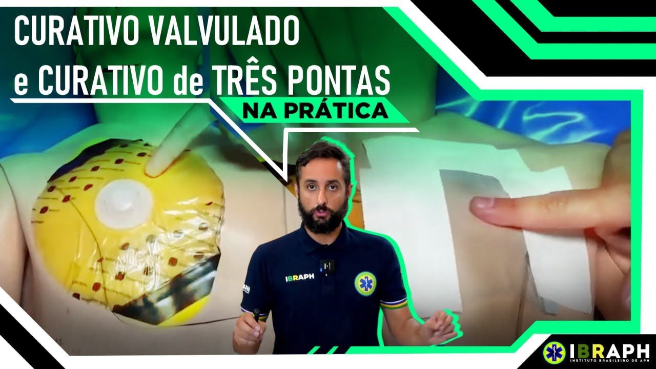 Selo de Tórax Valvulado e Curativo de 3 Pontas na Prática