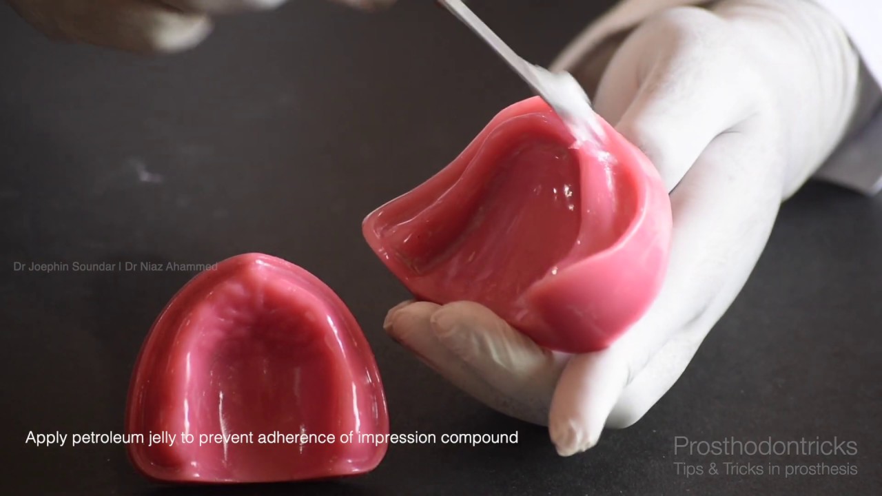 Preclinical Prosthodontics : Mandibular Edentulous Arch Impression Making - Impression Compound.