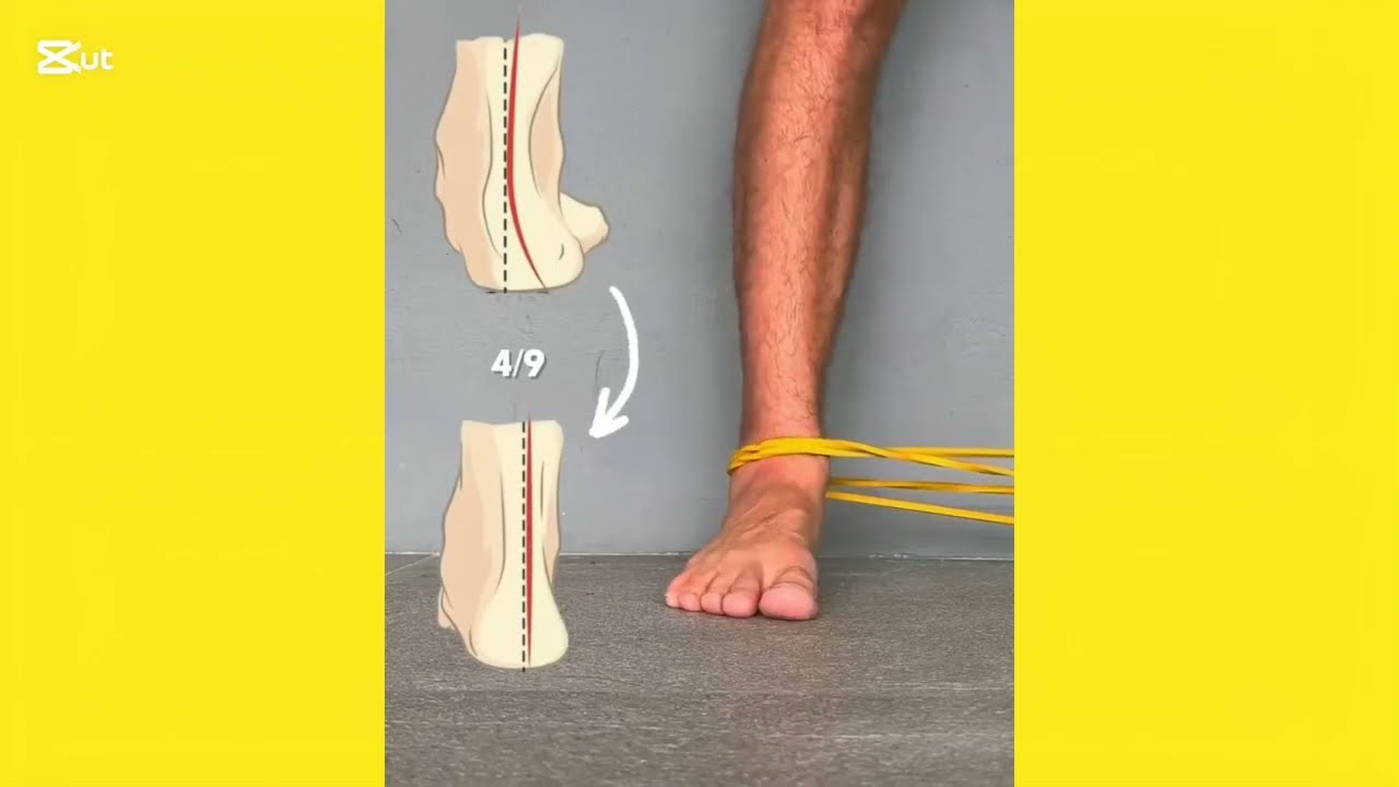 Flat Feet Correction Exercises &ndash; Improve Arch Support & Strengthen Your Feet