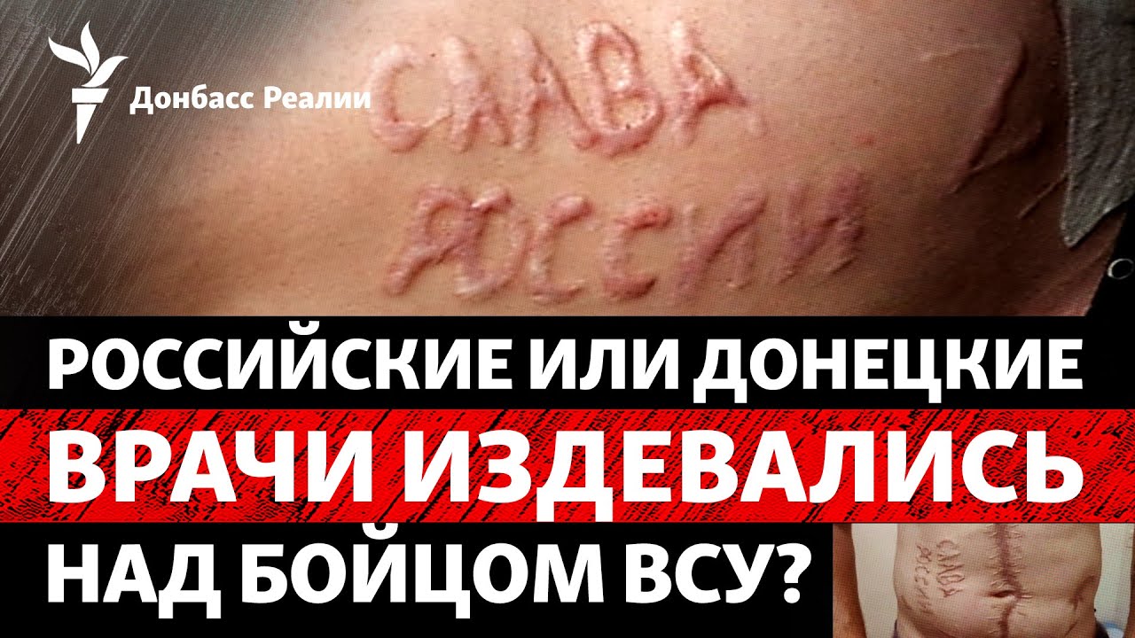 Россияне или донецкие? Врачи, которые могли выжечь «Слава России» на теле бойца|Радио Донбасс Реалии