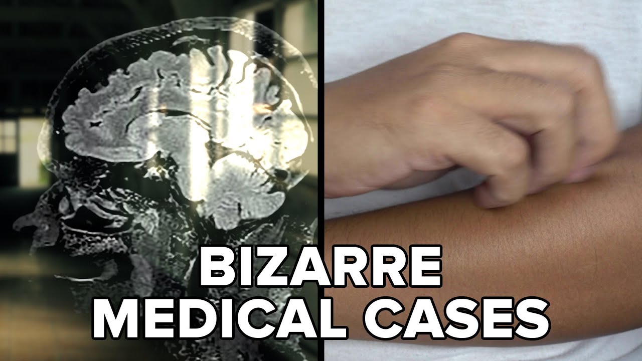 Bizarre Medical Cases That Still Confuse Doctors