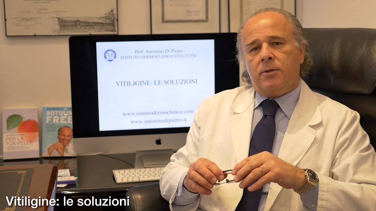 Vitiligine: le soluzioni