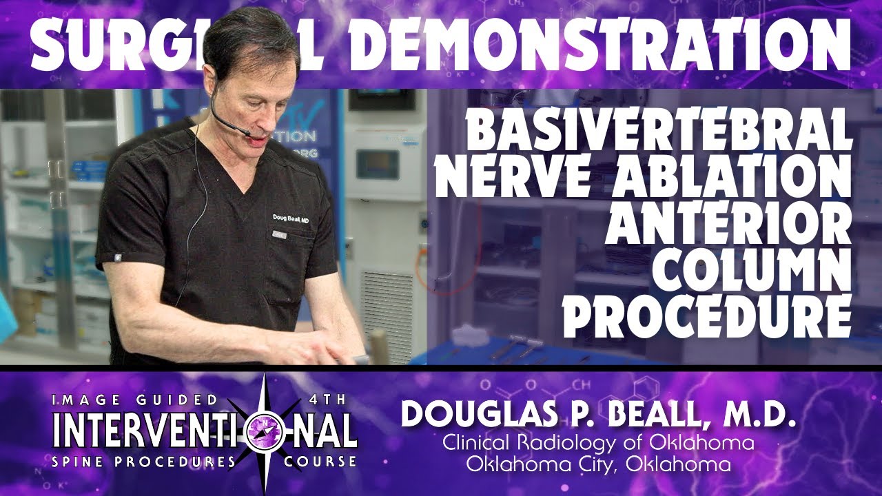 Basivertebral Nerve Ablation  Anterior Column Procedure - Douglas Beall, MD