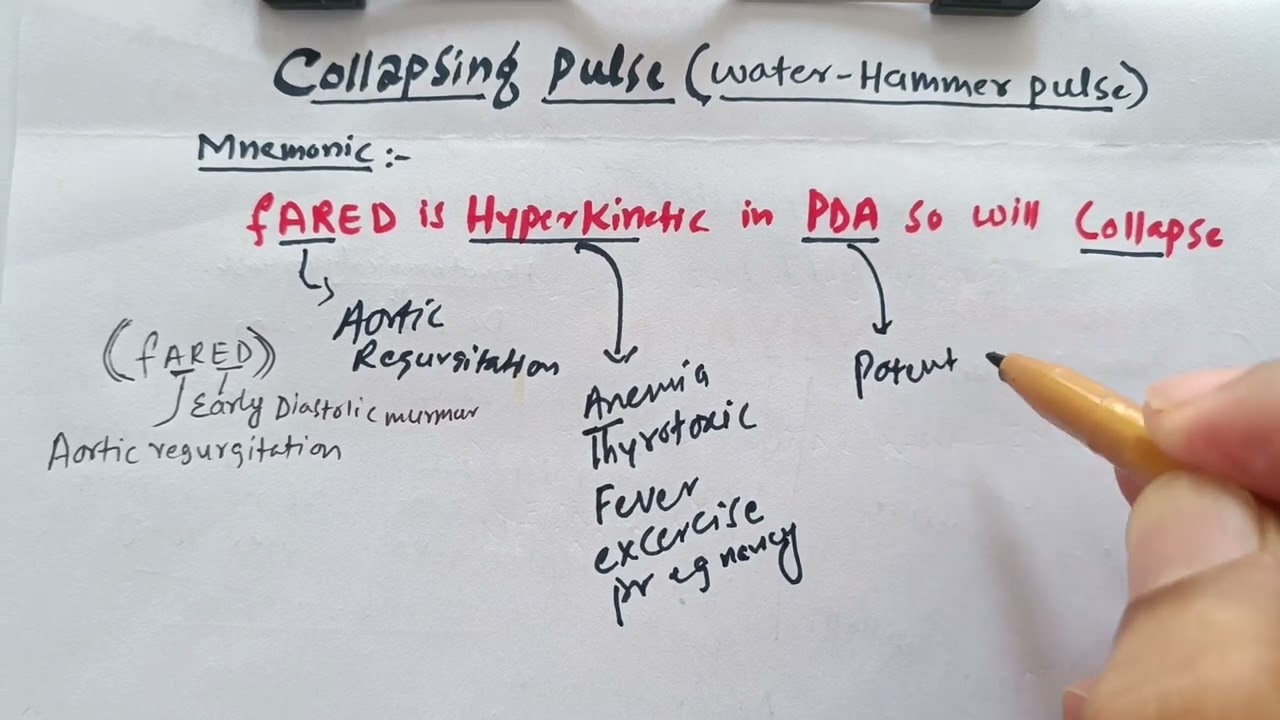 Collapsing pulse (water_hammer_pulse) mnemonic in less than 2 minute