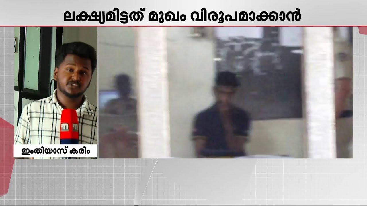 യുവതിക്ക് നേരെ ആസിഡൊഴിച്ചത് മുഖം വിരൂപമാക്കാൻ; പ്രതി പ്രശാന്തിന്റെ മൊഴി പുറത്ത് | Kozhikode