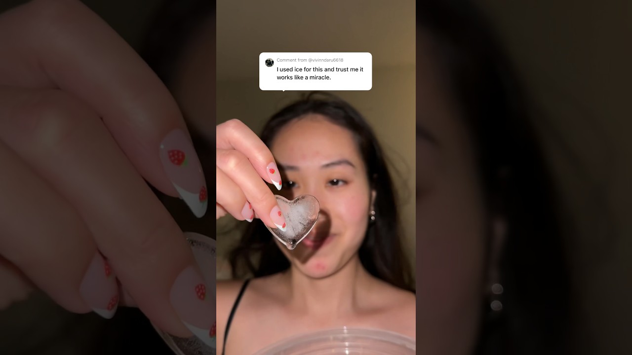 ICING my hormonal acne?? 🥶🧊 #hormonalacne #acneprone #acneproneskin