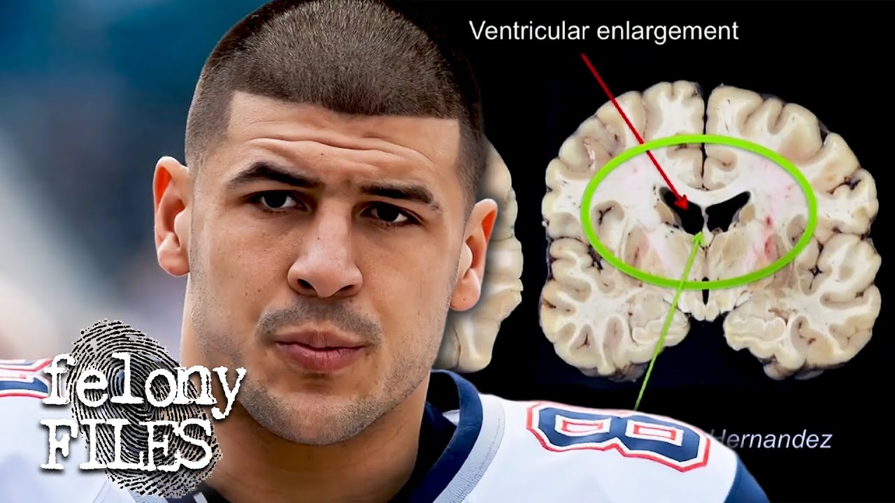 Did Brain Damage Cause Aaron Hernandez To Kill? | Aaron Hernandez Uncovered | Felony Files