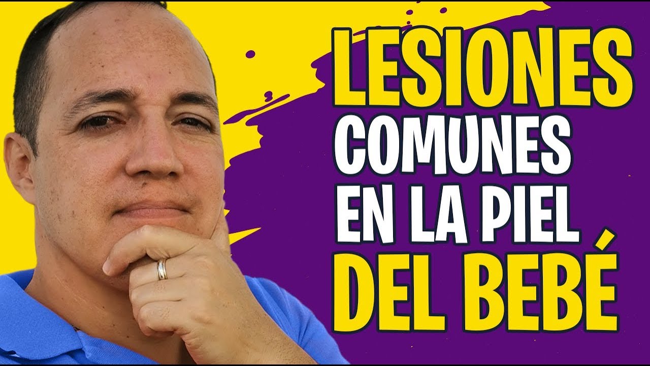Lesiones más comunes en la piel del bebé. ¡Identifícalas y trátalas adecuadamente!