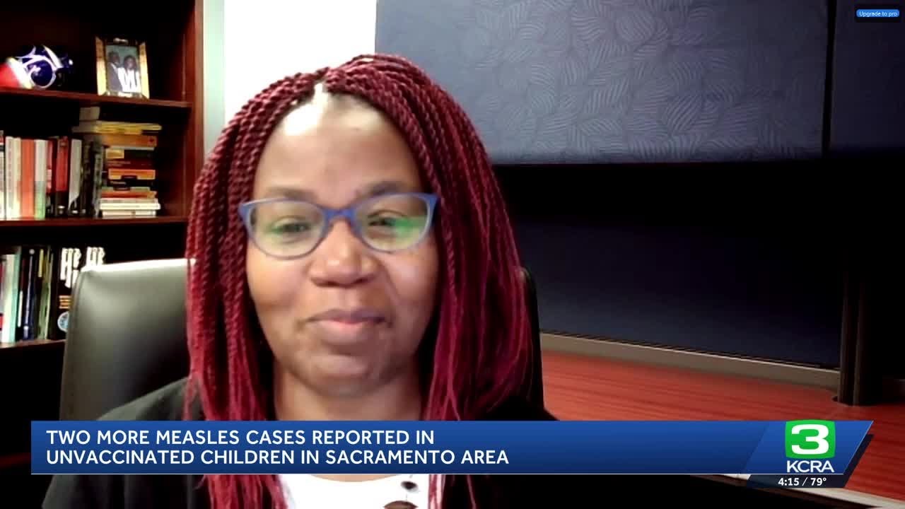 Sacramento County confirms 2 additional measles cases, bringing the total to 5 this year so far