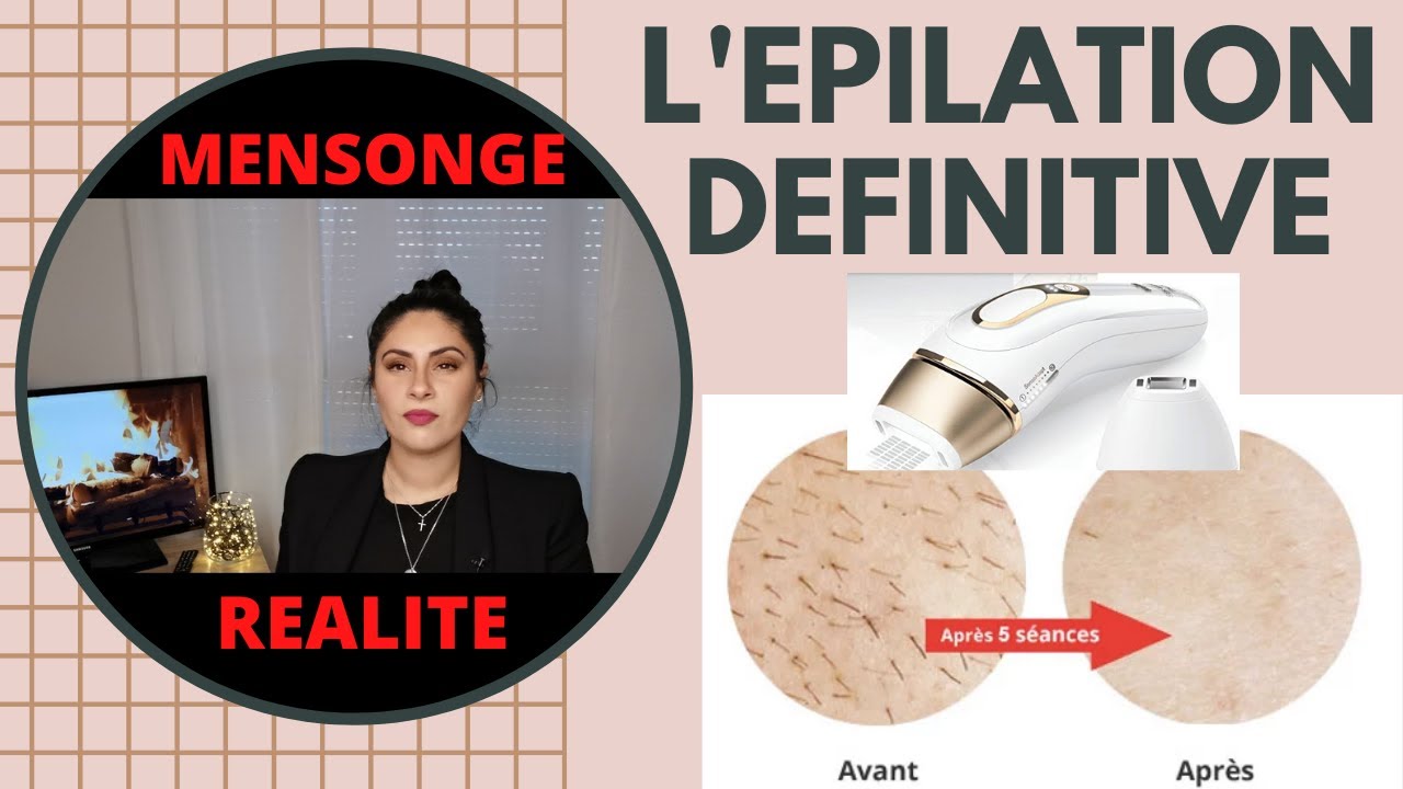 Mon EXPÉRIENCE : épilation à la lumière pulsée. 1an après on veut les résultats ! | SO JAY