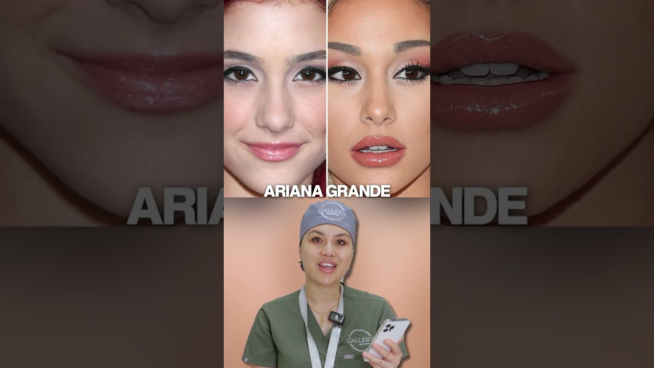Plastic Surgeon Reacts to Ariana Grande Plastic Surgery Transformation ￼