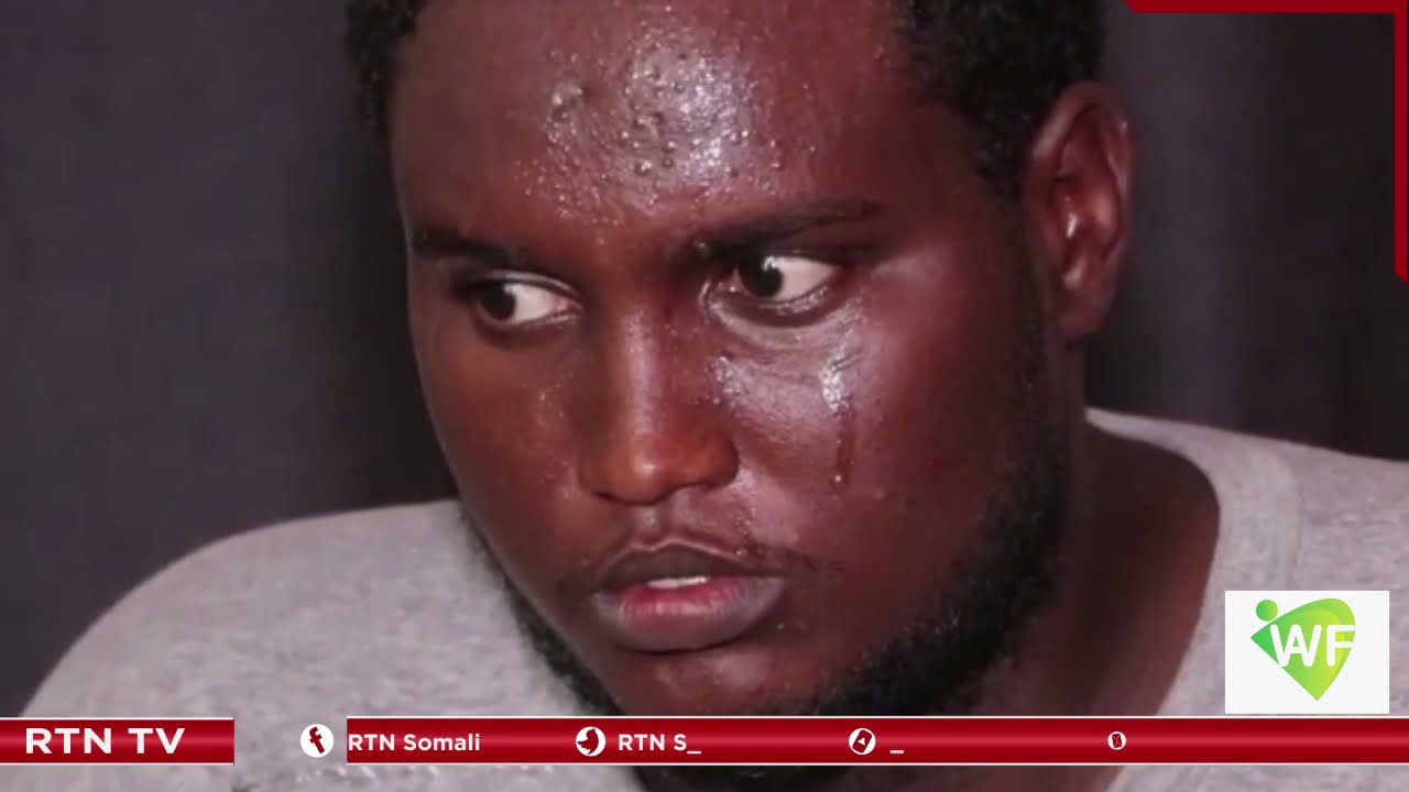 4 sano kadib qaraxii 14-kii October, weli waxaa jira dhibanayaal dhaawac jireed iyo maskaxeed qaba ,