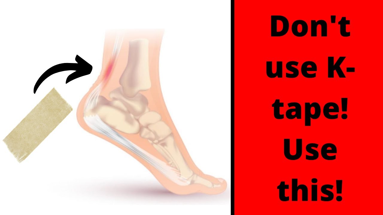 Taping for Achilles Tendonitis - two techniques you won't find anywhere else!