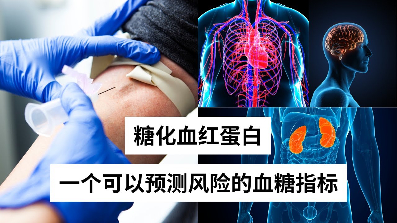 Ep 27 糖化血红蛋白 一个可以预测风险的血糖指标 ｜HbA1C ｜慢性疾病｜糖尿病 ｜血糖检验 ｜心脑血管疾病 ｜高血压 ｜