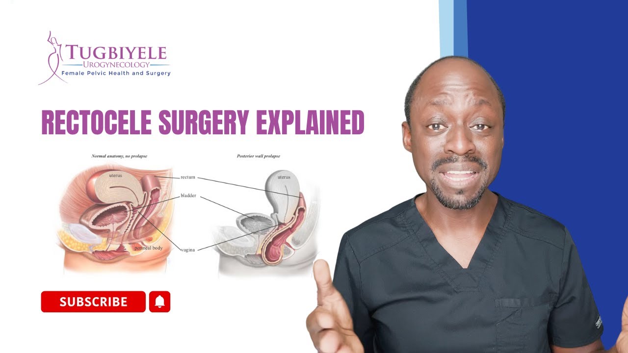 Rectocele Surgery Explained: Causes, Procedure, Recovery