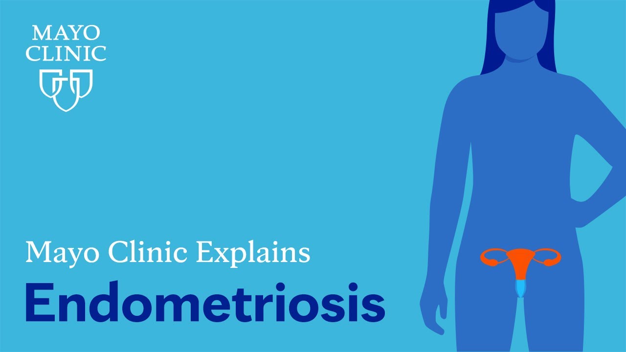 Mayo Clinic Explains Endometriosis