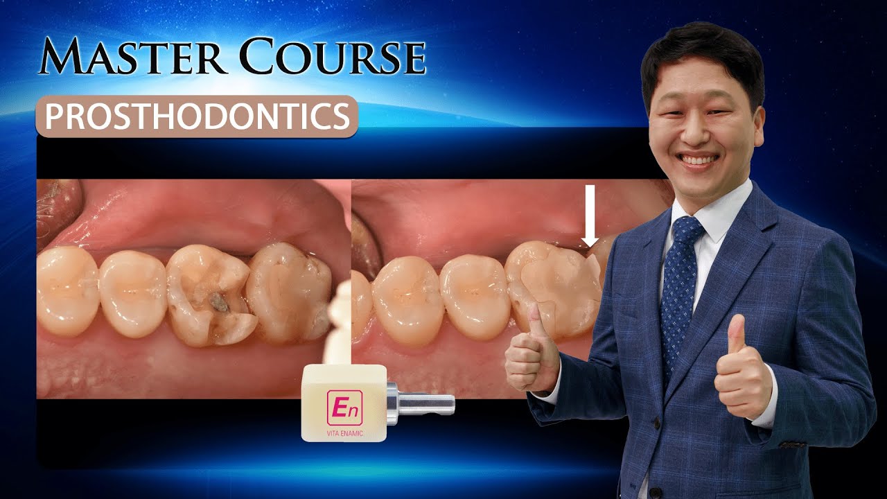 [Master Course - PROSTHODONTICS] Milling workflow for digital_dentistry
