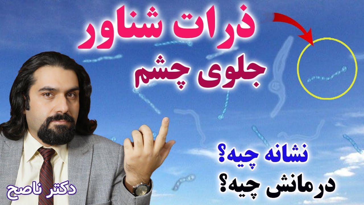 ذرات شناور جلوی چشم خطرناکه؟ درمانش چیه؟ مگس پران به زبان ساده با دکتر ناصح