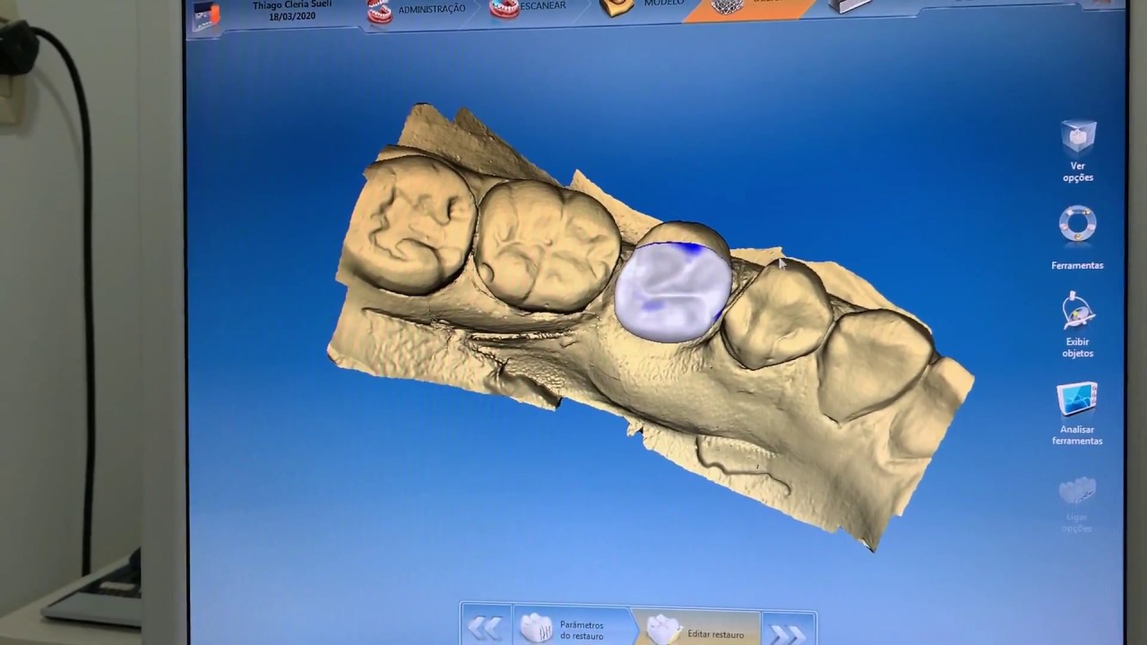 Como exportar projetos do Cerec e Inlab (todas as versões 4.0/4.2/4.3/4.4/4.5/4.6) em STL