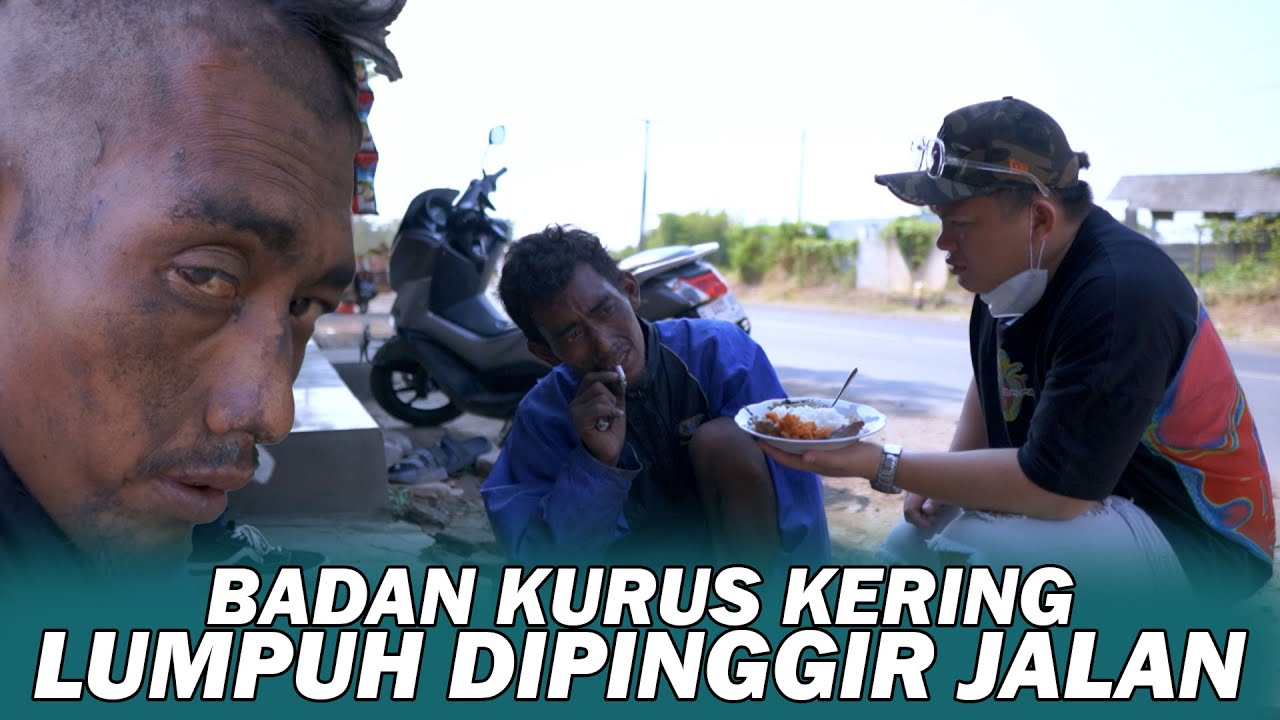 PEMUDA GANTENG 😱 KURUS KERING LUMPUH TIDAK BISA JALAN DIPINGGIR JALAN