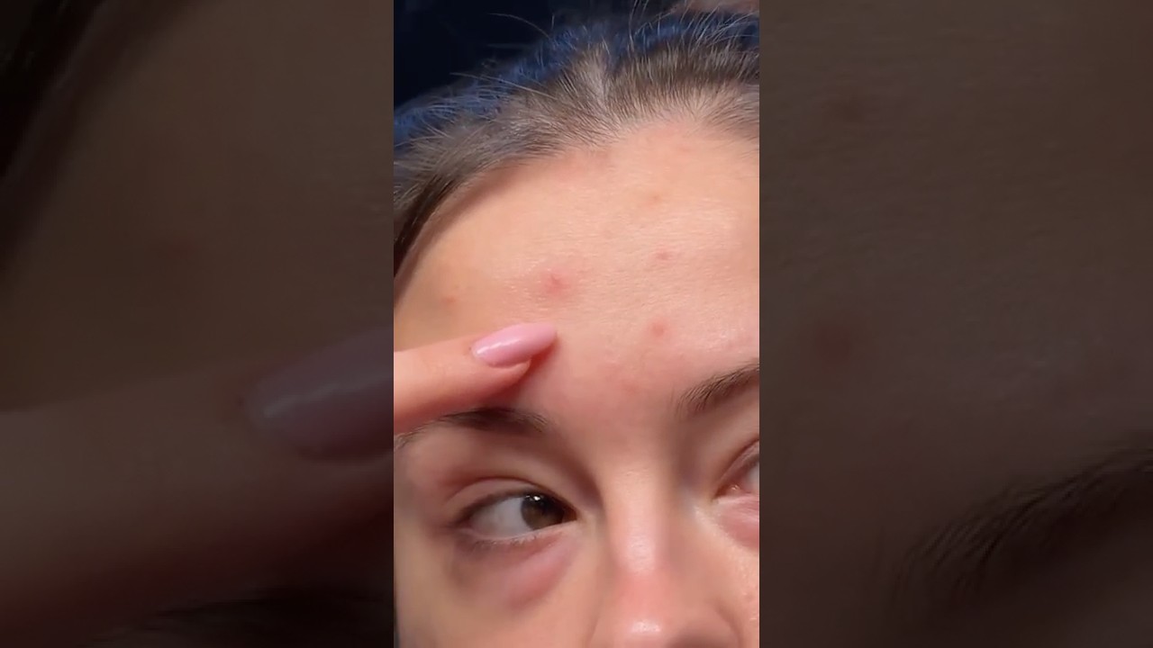 TYM PRODUKTEM USUNIESZ KROSTY W KILKA GODZIN!