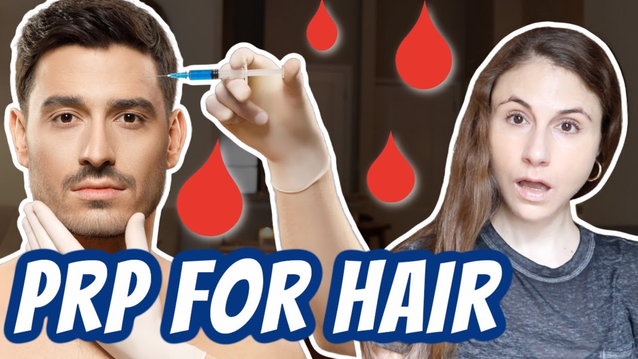 Platelet rich plasma (PRP) for hair loss| Dr Dray