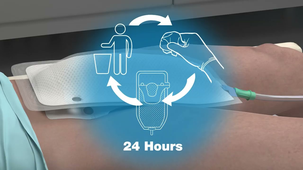 PureWick Male In service video