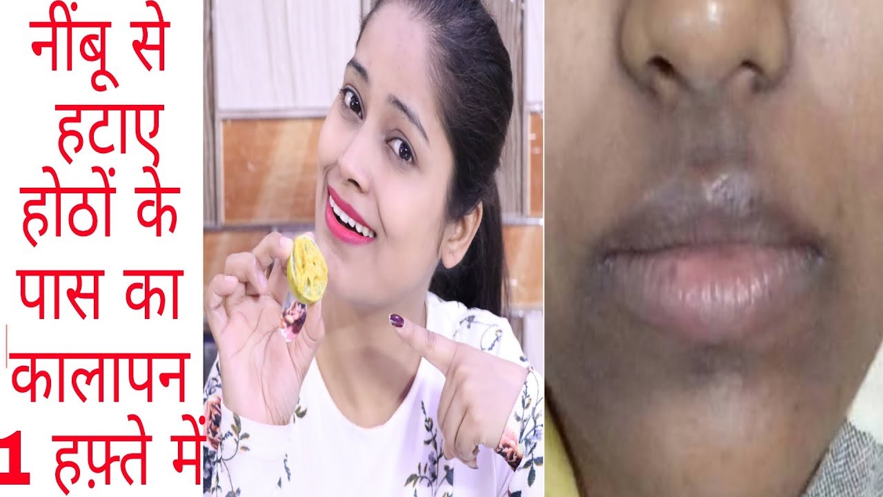 होठों के पास के काले घेरे को नींबू से हमेशा के लिए ठीक करे|Remove darkspots,pigmentation aroundmouth