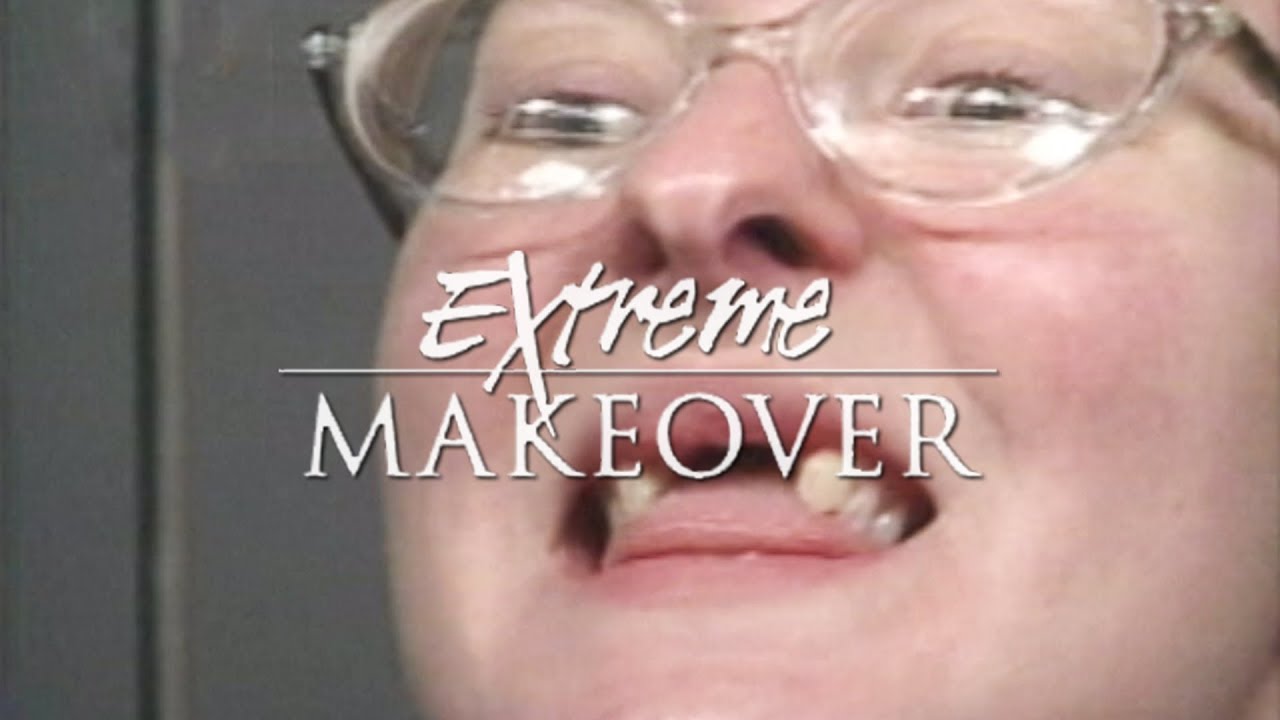Dr Bill Dorfman Transforms Christys Smile on ABCs Extreme Makeover