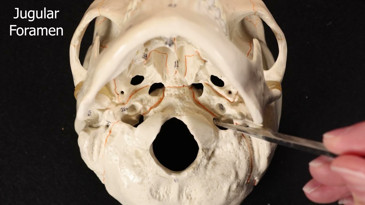 Temporal Bone #skullanatomy